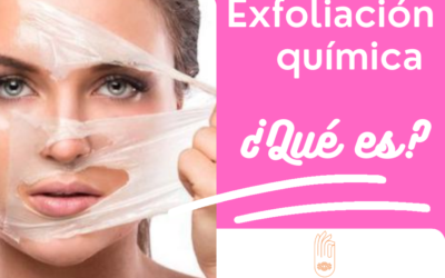 La exfoliación química, ¿qué es?